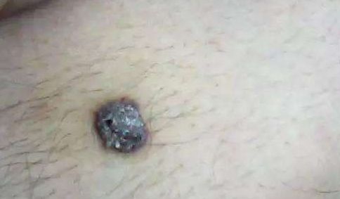 佛山醫(yī)生榜單：受人推崇的業(yè)界認可名單曝光