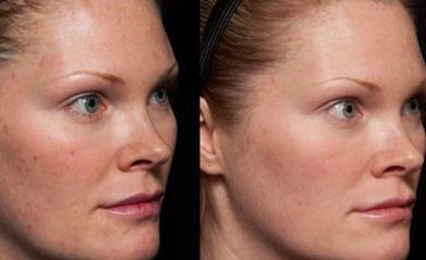 2023年南京磨骨醫(yī)生排行榜！這5位專家大咖讓您眼前一亮！