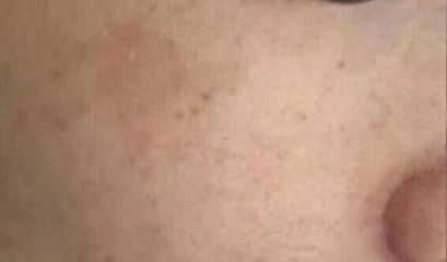 南京優(yōu)質(zhì)雙眼皮修復(fù)醫(yī)生推薦，5位專家點(diǎn)評述評