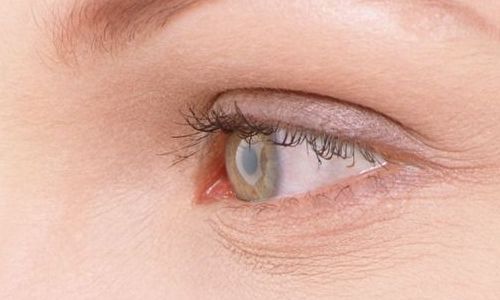 航空院眼袋手術(shù)效果如何？最新案例分享