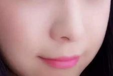 泉州吸脂整形醫(yī)院排行榜：選擇這幾家就能放心安心