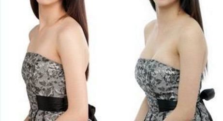 全國哪里可以找到專業(yè)的拉皮手術(shù)醫(yī)生？2023比較好幫手來了！