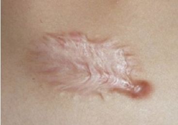 天津市最受歡迎的雙眼皮整形醫(yī)院排行榜發(fā)布，熱度爆表！