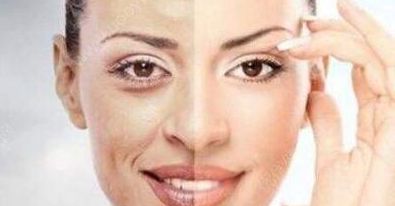 成都賈德淵醫(yī)生的眼睛技術(shù)有何不同？80天變化詳解