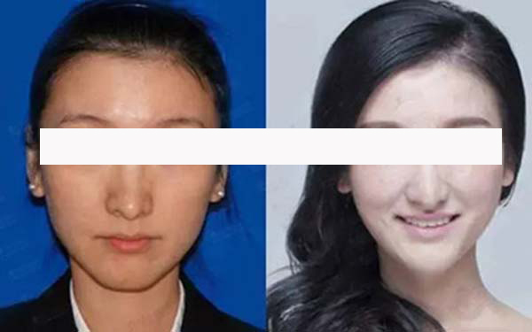 寧波藝星整形和珈禾整形，哪家更具實(shí)力？醫(yī)生口碑、項(xiàng)目擅長(zhǎng)和地址公布等方面的對(duì)比如何？