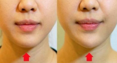 重磅發(fā)布！南京五家面部吸脂醫(yī)院排行盛況揭曉！