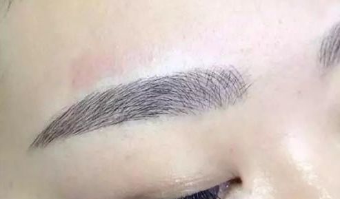 昆明祛斑哪家醫(yī)院更受歡迎？大眾口碑告訴你答案！