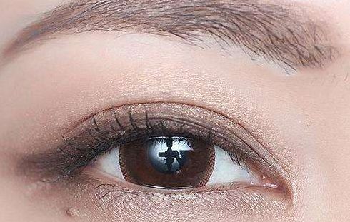 林琳雙眼皮修復(fù)失敗案例分享，術(shù)后視野恢復(fù)亮眼！