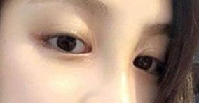 如何選擇合適的醫(yī)生，讓你的身材變得完美無(wú)暇