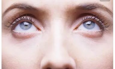 崔向葵雙眼皮整形手術效果如何？了解一下!