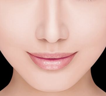 哈醫(yī)大四院李巍主治醫(yī)生鼻整形手術(shù)！80天重塑完美鼻型全記錄！