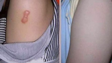 上海知名醫(yī)生手術(shù)CG費(fèi)用曝光，驚人低價(jià)吸引眾多患者！