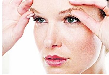 上海九院陳輝醫(yī)生_激光去斑案例分享：擁有細(xì)膩肌膚的秘訣曝光