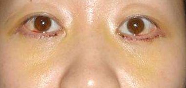 重慶鼻部整形十大備受推崇的醫(yī)生，擔當醫(yī)界翹楚技藝無敵