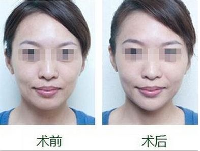 沈陽市的專業(yè)雙眼皮整形醫(yī)院哪家好，排名前三值得信賴