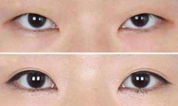 矚目！莊洪興醫(yī)生的綜合評(píng)價(jià)和形象考察