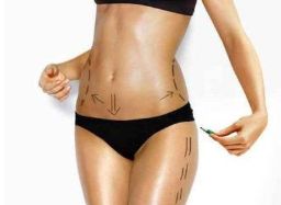 齊魯醫(yī)院大腿抽脂案例分享：專家解析、費用說明、效果好嗎