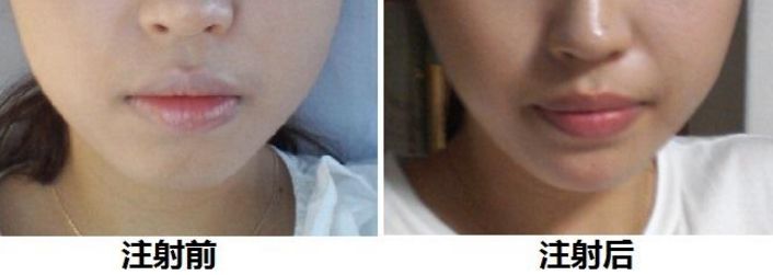 廈門哪里有靠譜的美容整形醫(yī)院？專家推薦的名氣大、信譽(yù)好的！