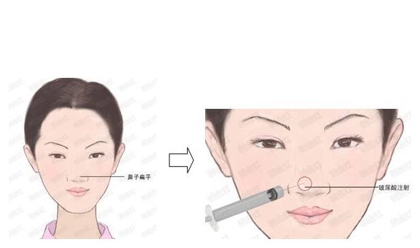 河南省整形醫(yī)院推薦：華領(lǐng)、維多利亞與締萊美大放異彩！