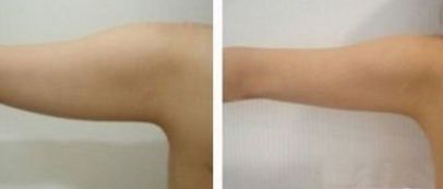 西部戰(zhàn)區(qū)一流眼科專(zhuān)家介紹，技術(shù)評(píng)估及收費(fèi)參考