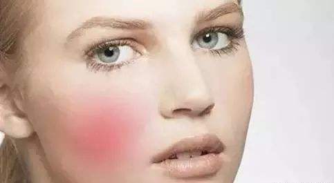 合肥哪家醫(yī)院的眼科修復(fù)效果好？眼部整形哪家醫(yī)院口碑比較好？