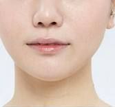 國(guó)內(nèi)哪些醫(yī)院在頜面整形方面做得更好？?jī)?yōu)質(zhì)正頜手術(shù)醫(yī)院推薦