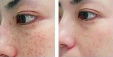 成都整形醫(yī)院排行揭曉！驚喜實(shí)力醫(yī)院都榜上有名