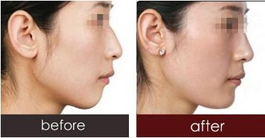 深圳哪些醫(yī)生已獲得2023年喬雅登認(rèn)證？全新名單發(fā)布！