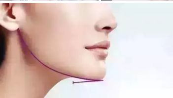 長沙愛思特整形醫(yī)院：正規(guī)可信賴，服務周到！