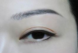 深圳著名眼袋整形專(zhuān)家?guī)湍獯?，鵬程醫(yī)院是否值得選擇？