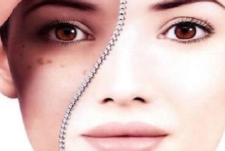 秦皇島一家專業(yè)整形醫(yī)療機構的雙眼皮手術效果如何，哪位醫(yī)生技術高超？了解手術價格可供參考