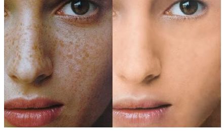 成都維度整形醫(yī)生技術(shù)點(diǎn)贊！實(shí)例曝光，周維做鼻子效果驚艷！