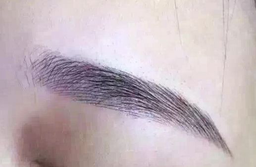 長沙脂肪吸取專家揭秘：技術(shù)卓越，無數(shù)口碑背后的醫(yī)美奇跡！