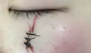 南京智美顏：了解2023吸脂案例曝光，發(fā)現(xiàn)醫(yī)療美容的驚人效果！