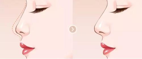 寧波韓美整形吸脂值得信賴嗎？