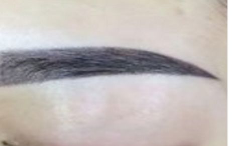 深圳哪家醫(yī)院的面部除皺效果出眾？透露美萊、鵬程、藝星等實力醫(yī)院排行榜