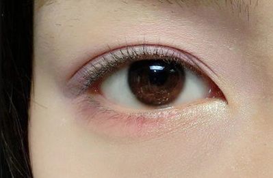 貴陽(yáng)市激光脫毛服務(wù)品牌推薦