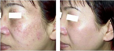 醫(yī)生付德剛面雕案例揭露！技術(shù)如何？詳細(xì)信息公布，附醫(yī)院詳解！