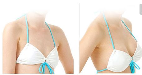 金長鑫哪種技術(shù)祛眼袋效果更佳？眼袋手術(shù)最新案例解析！