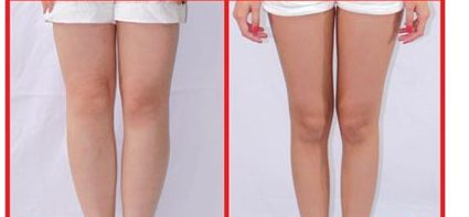 昆山人民醫(yī)院美容科提供哪些整形項(xiàng)目？著名醫(yī)師坐診+讓您雙眼煥發(fā)迷人魅力！