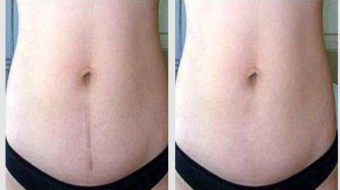 深圳很受推崇的雙眼皮修復醫(yī)生榜單發(fā)布！探尋盡善盡美之道