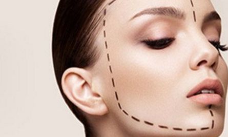 薛紅宇雙眼皮整形，獨特技術(shù)展示令人驚嘆