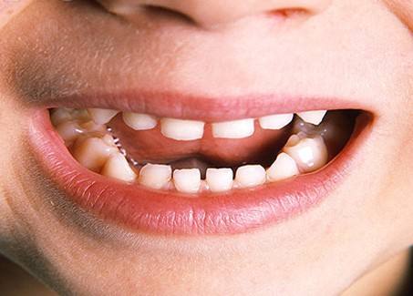 整形世界中，張笑天下頜角整形大概需要多少費用？醫(yī)院技術是如何保障的？