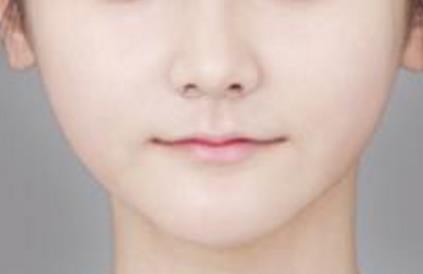 呼和浩特鼻部整形有哪些醫(yī)院可以信賴？為您推薦理想選擇