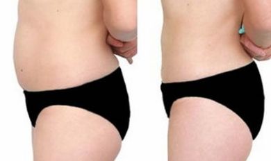 沈陽醫(yī)大一院醫(yī)美，尋覓技術高超的大夫，暢談假體隆鼻案例！