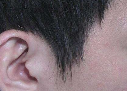 上海美容醫(yī)院盤點(diǎn)口碑排名，隆胸手術(shù)費(fèi)用公開曝光！