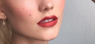 北京八大處整形外科醫(yī)生趙延勇的項目特長及真實去眼袋案例分享