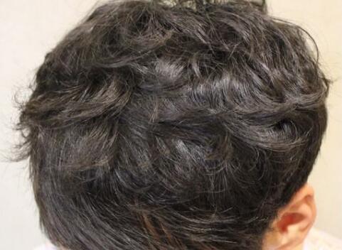 沈陽(yáng)整形醫(yī)院哪家技術(shù)更先進(jìn)？有哪些正規(guī)醫(yī)美機(jī)構(gòu)？（附詳細(xì)價(jià)目表）