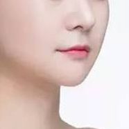 重磅推薦！全國頂級雙眼皮修復(fù)專家榜單揭曉，這四位醫(yī)師備受贊譽