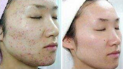 蘇州人民醫(yī)院整形科割眼袋靠譜嗎？專家資料簡介，網友評價如何？